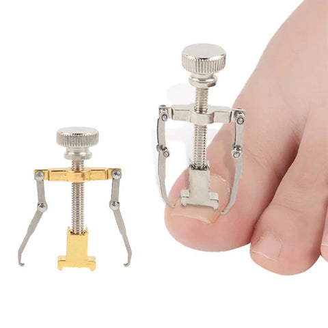 Ingrown Toenails Correcter