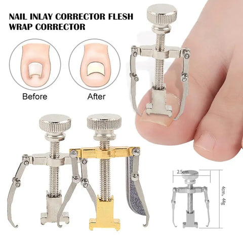 Ingrown Toenails Correcter