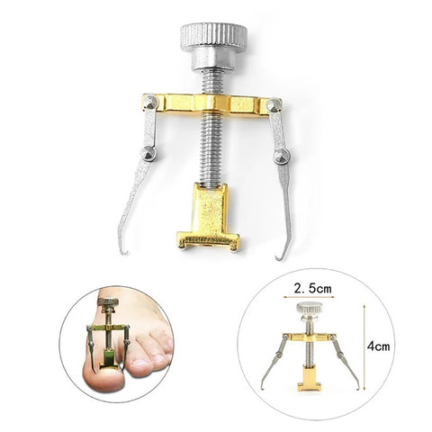 Ingrown Toenails Correcter