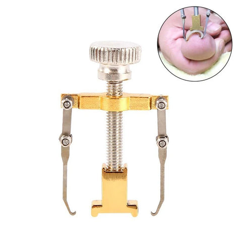 Ingrown Toenails Correcter