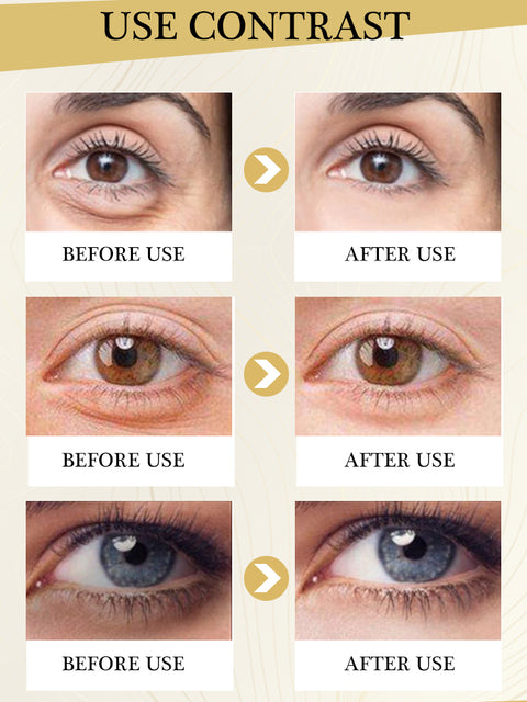 Eye Bags Wrinkle Removal Eye Cream