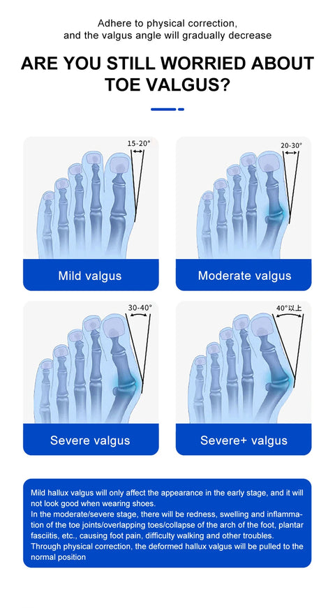 Toe Orthopedic Corrector