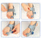 Toe Orthopedic Corrector