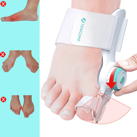 Toe Straightener Corrector
