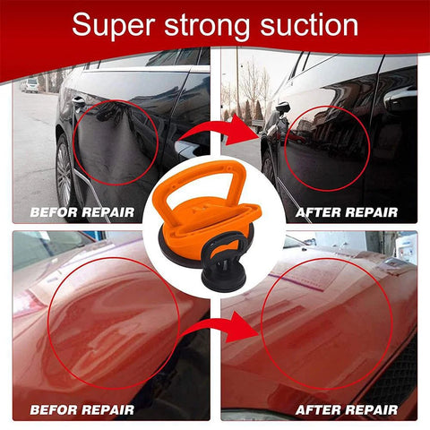 DentLift Pro Suction