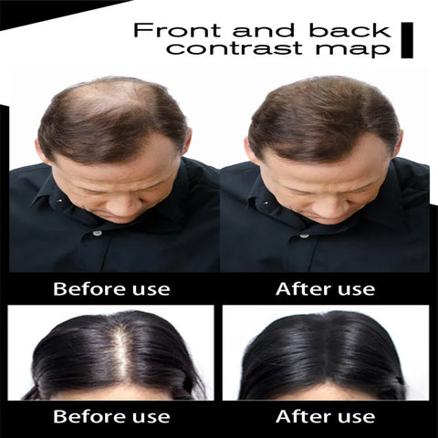 27.5g Hair Fiber Keratin Thickening Spray