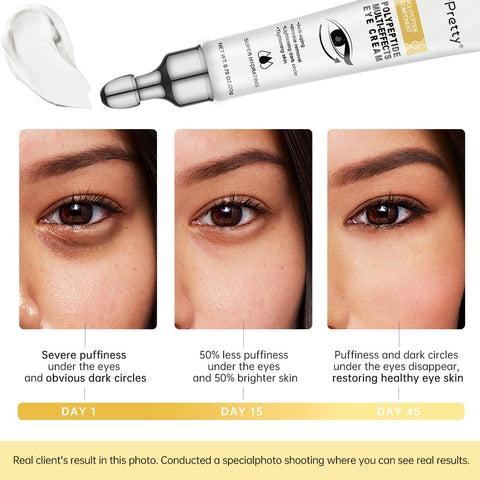 Eye Bags Wrinkle Removal Eye Cream