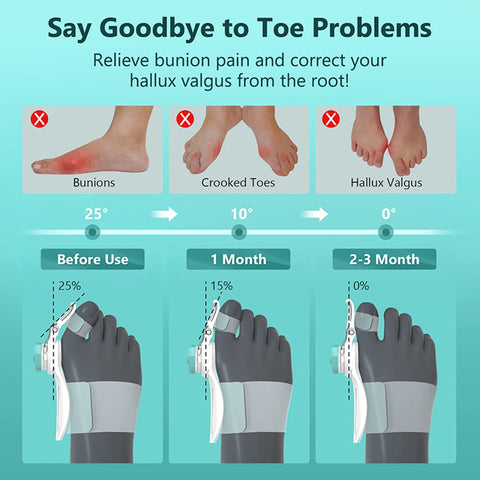 Toe Straightener Corrector