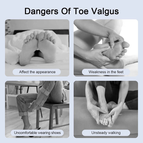 Bunion Toe Orthopedic Corrector