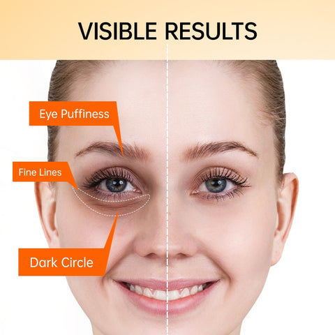 Vitamin C Anti Dark Circles Eye Cream