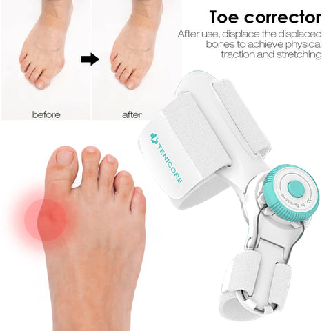 Toe Straightener Corrector