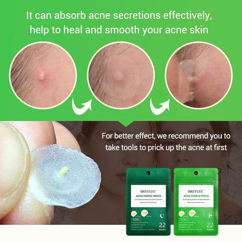 BREYLEE Acne Pimple Patch
