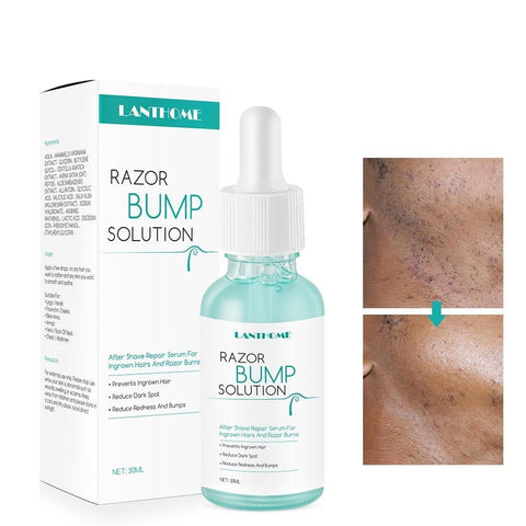 LANTHOME Razor Bump Solution for Ingrown Hair
