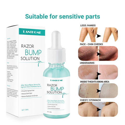 LANTHOME Razor Bump Solution for Ingrown Hair