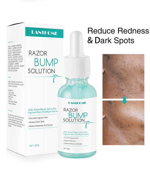 LANTHOME Razor Bump Solution for Ingrown Hair